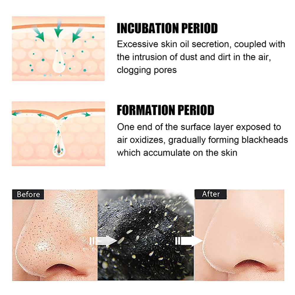 10-100Pcs Blackhead Remover Ma - Nasal Aspirator review and price